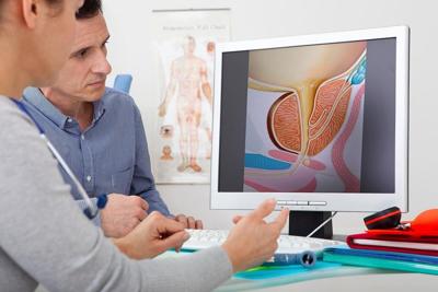Advanced Prostate Cancer Cases Rising as Fewer Men Are Screened, New Report Says