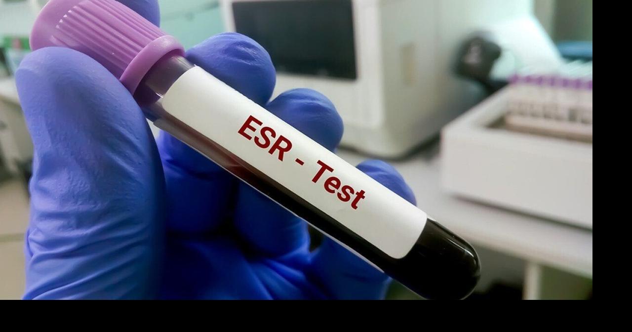 Study examines whether dropping ESR tests actually lowers costs