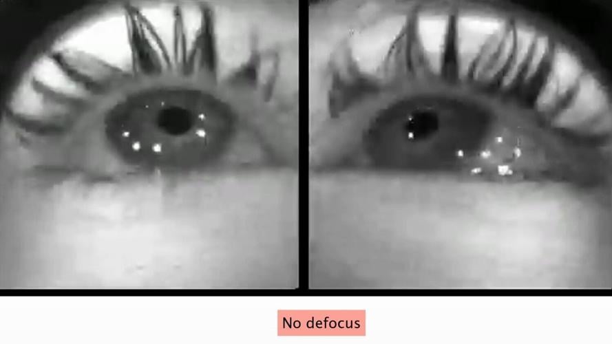 short-sightedne–1504076