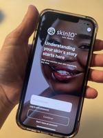 App fine-tuned at Lancaster innovation lab uses AI to spot skin cancer
