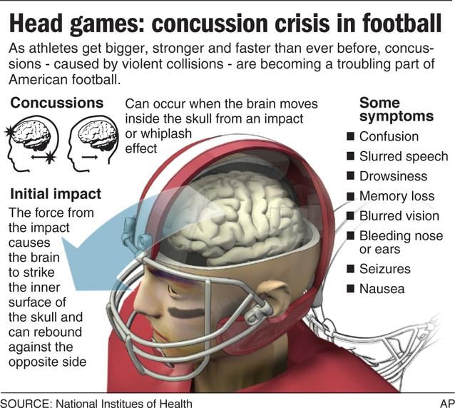 ‘concussion And What You Should Know About Sports And Brain Injuries Local News 