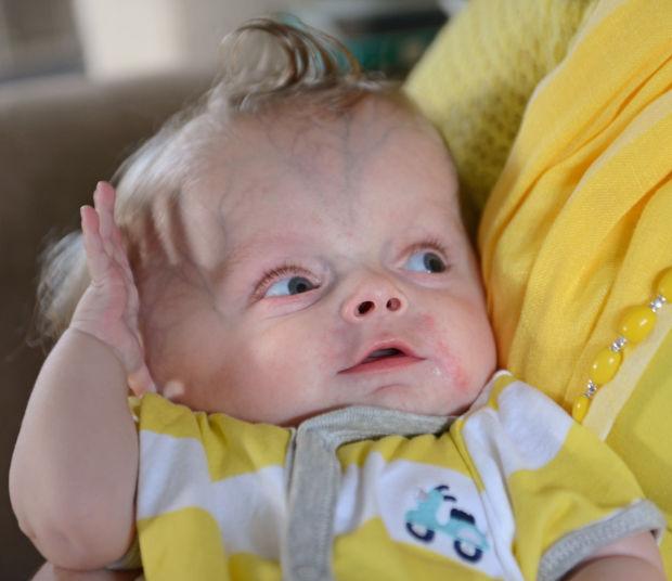 Unbreakable spirit: Spunky infant with fragile bones shows the 'true