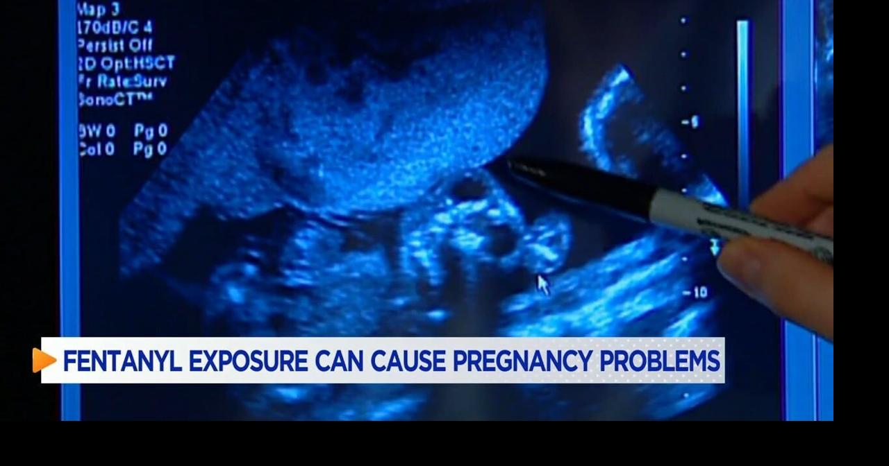 Fentanyl exposure while pregnant can problems during and after birth