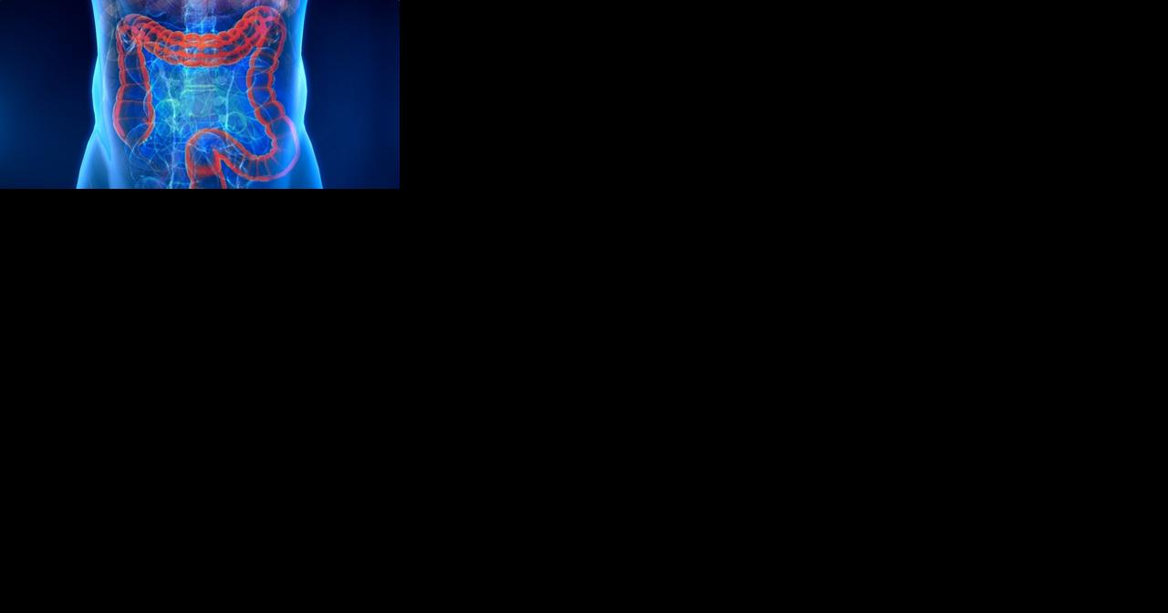 EYE ON HEALTH: Colon cancer survivor warning others to not skip screenings - Vimarsana News