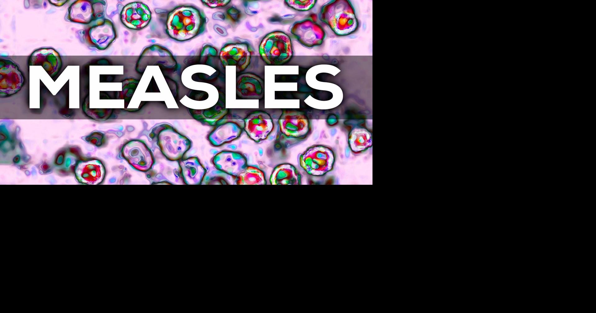 First Measles Case in Tennessee Amid National Outbreak