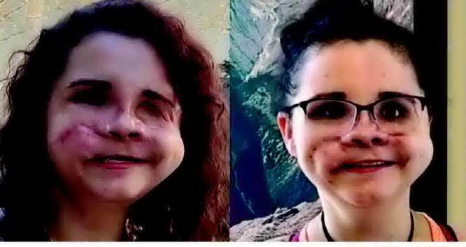 Face of recovery