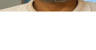 46-year-old Sandy Springs Man With Autism Missing - Vimarsana News