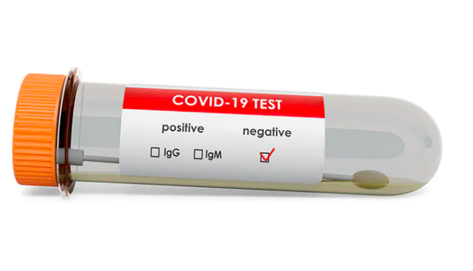 fake negative covid test results template free