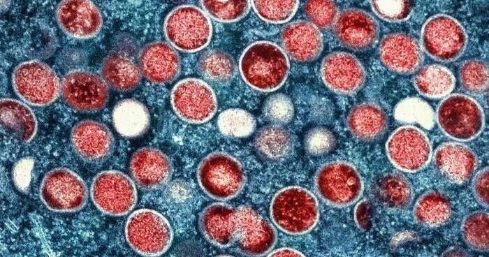Montana researchers accused of smuggling Monkeypox into the U.S. from the Republic of Congo