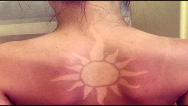 Sunburn shifts Thai tattoo  Stuffconz