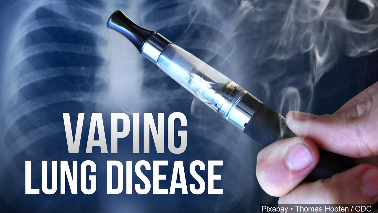 Cases of severe lung illnesses possibly tied to vaping reported in