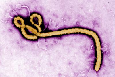 Ebola Virus
