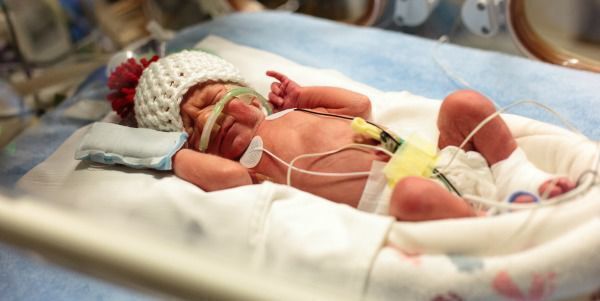 These Nebraska quadruplets are rare indeed