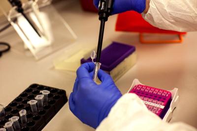 Microbiologist Sarah Riddick of the Monterey County Public Health Lab in Salinas uses a pipette to collect a patient sample