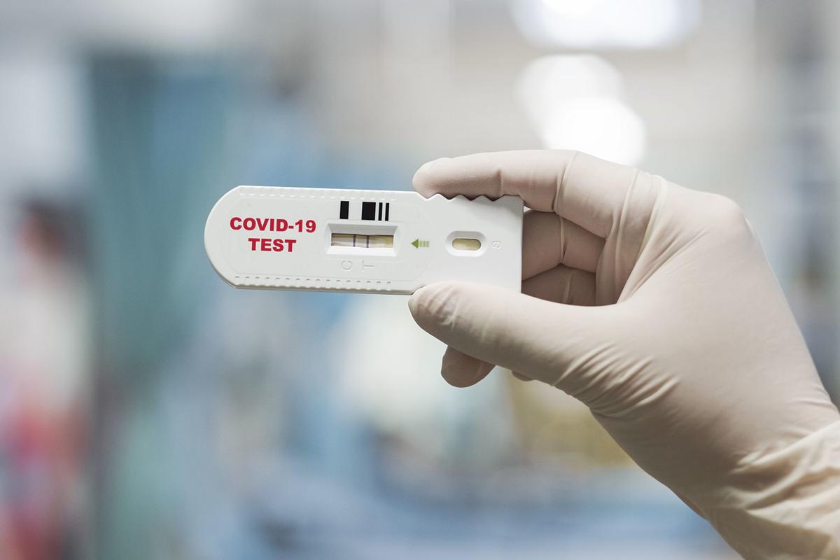 antibody coronavirus generic