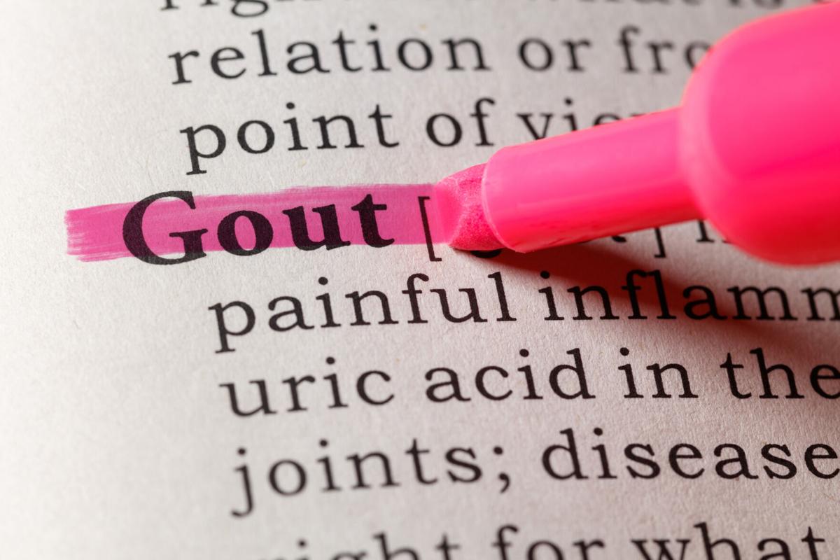 Study highlights best way to prevent gout