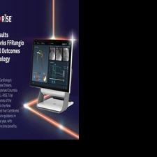 Landmark ALL-RISE® Trial Results Presented at ACC.26: CathWorks FFRangio Demonstrates Similar Clinical Outcomes to Invasive Wire-based Physiology Assessment