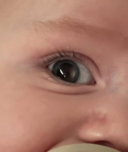 Mum thought baby’s “wonky” eye was adjusting  but it was rare cancer
