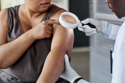 Melanoma and other skin conditions can look different in people with darker versus lighter skin – but image databases include many more examples from people with lighter skin.