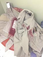 Sheriff’s Office deputy shoots dog attacking him in Cedar Hill