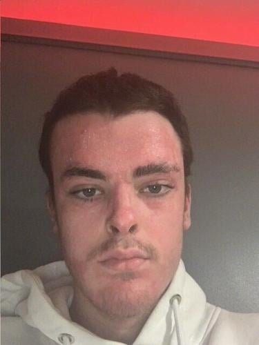 Horrific pictures show apprentice’s injuries after becoming ‘human fireball’