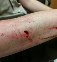 Pit bull bites Sheriff’s Office deputy