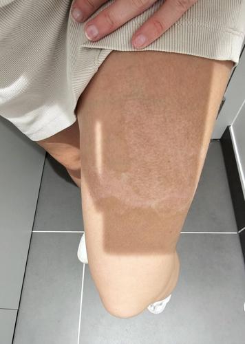 Mum gets £4k payout after cup of tea spills on her lap during Ryanair flight