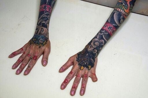 Retired yakuza Mako Nishimura shows her dragon and tiger tattoos and a finger cut off in a ritualistic self-punishment for blunders