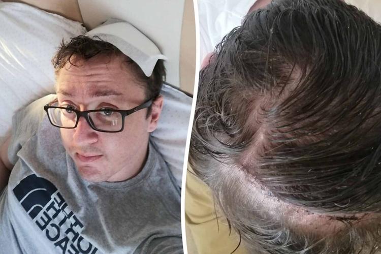 “I put headaches down to stressful architect job – I actually had a brain tumour”