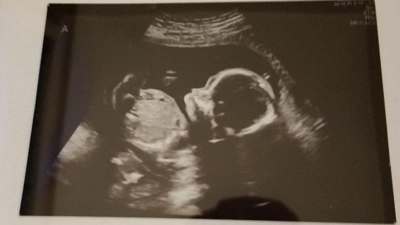 Grandmother to-be (part 2)