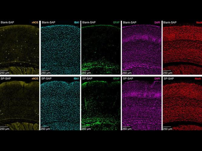 Stress may lead to altered blood flow in the brain, reveals study
