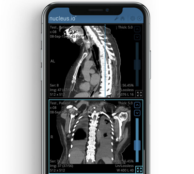 Change buys medical imaging venture