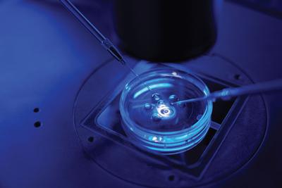Close-up of intracytoplasmic sperm injection being performed in a Petri dish