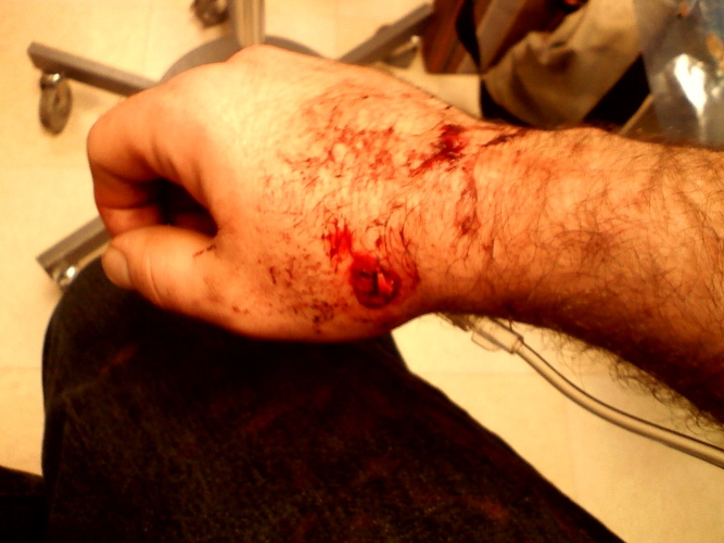 The Features and How I Became the Bomb to Play Benefit Show in Murfreesboro TONIGHT!!