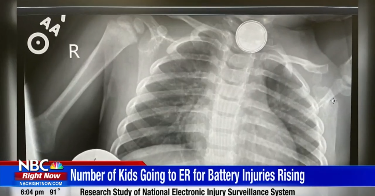 Across the country more kids in the ER after eating button batteries ...