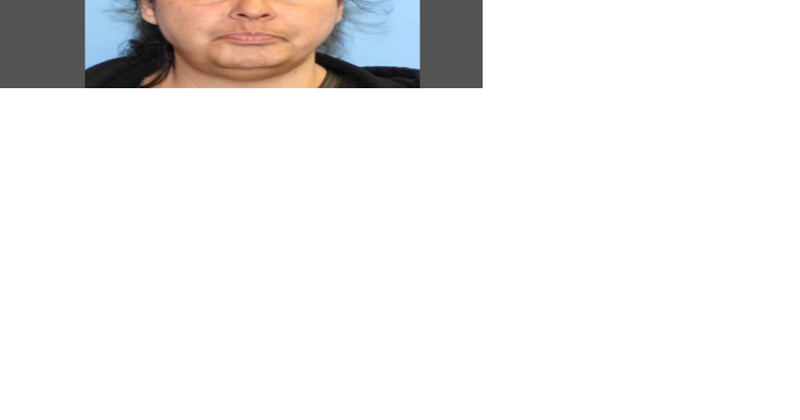YPD asks for help from community in locating missing woman - Vimarsana News