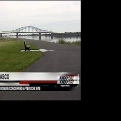 Woman Says She's Attacked by Dog, Now Looking for Owner | News ...