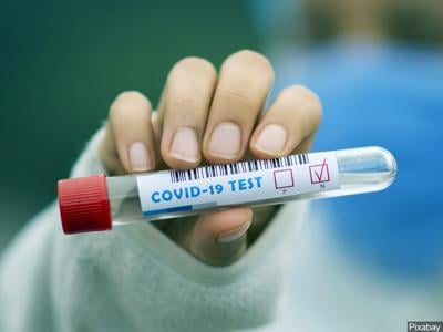 Registration Free Covid 19 Testing Sites In Sunnyside And Grandview Coronavirus Nbcrightnow Com