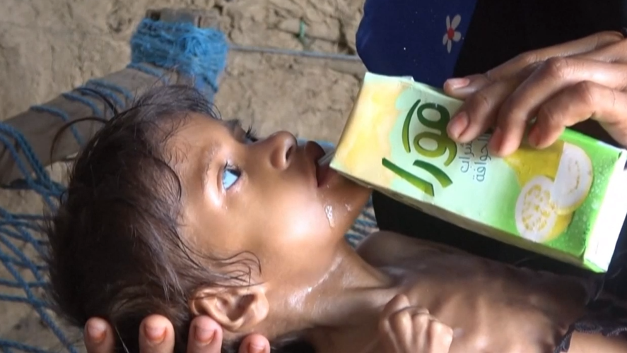 Millions of children on the brink of starvation in war-torn Yemen | Top ...