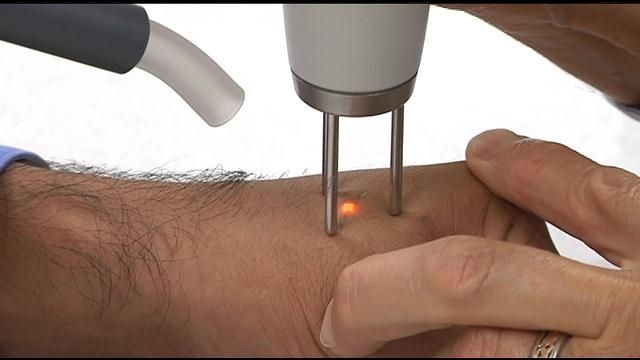 QSwitched ND YAG laser  Permanent tattoo Removal  Skinaa Clinic Jaipur   YouTube