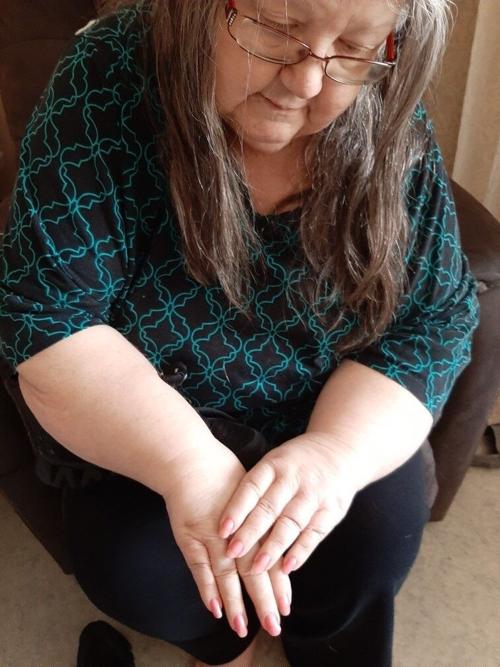 Resident Showing Off Her At Home Manicure