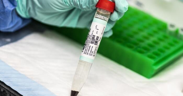 New funding will provide genetic genealogy testing for unidentified remains in Washington - Vimarsana News