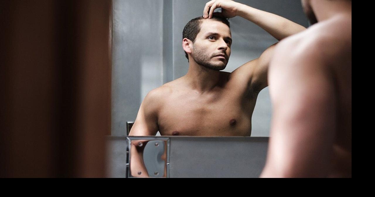 Baldest states: See how Idaho ranks for hair-loss medication prescriptions