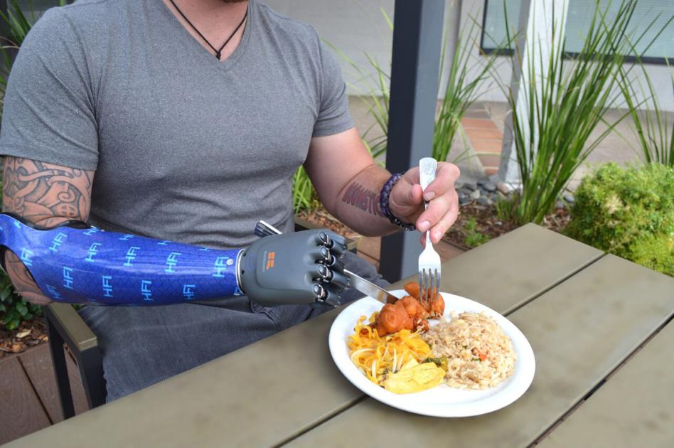 AI-powered bionic hand promises lifelike dexterity | Business | news-journal.com - Longview News-Journal