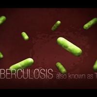 CDC Tuberculosis (TB) Transmission and Pathogenesis Video | Covid-19