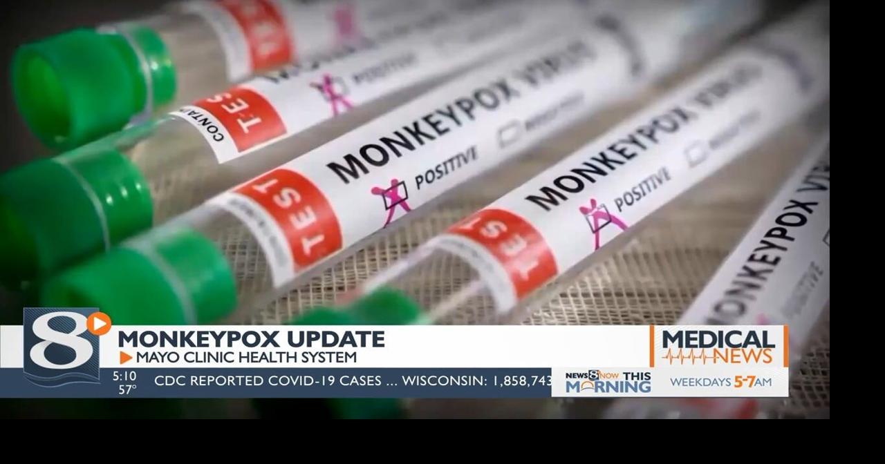 La Crosse doctor says smallpox vaccine offers some protection against