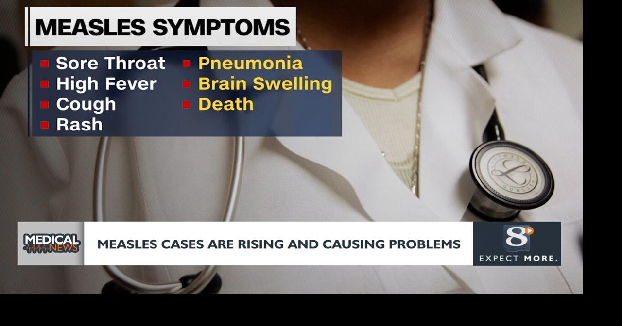 Medical News: Canada looses measles-elimination status