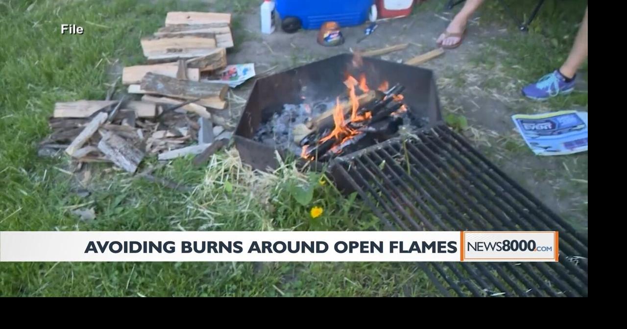 Grills and campfire can be cause of preventable injuries, UW Health ...