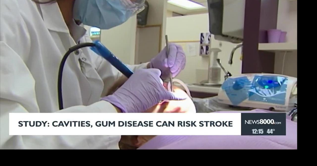 Health headlines: Cavities and gum disease can risk stroke | Health ...
