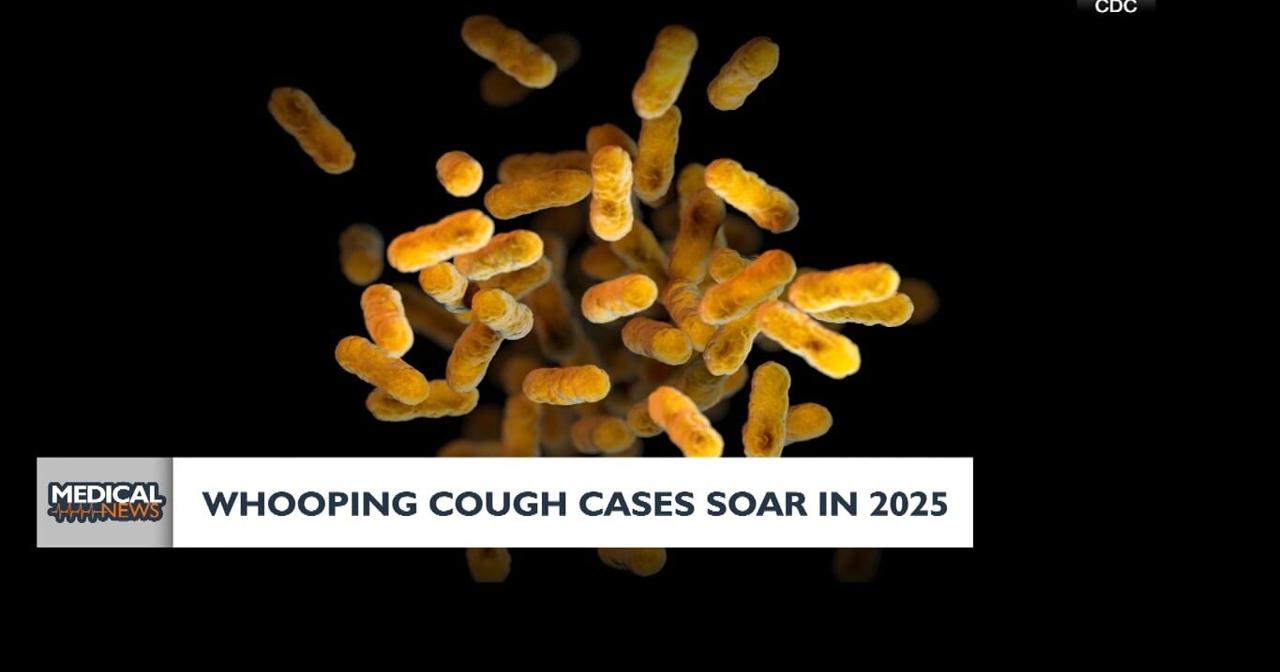 Medical Headlines: Whooping cough cases soar in 2025